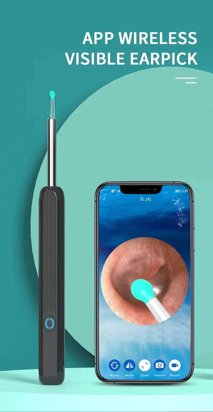 NE3 Otoscope oreille : suppression de cérumen.