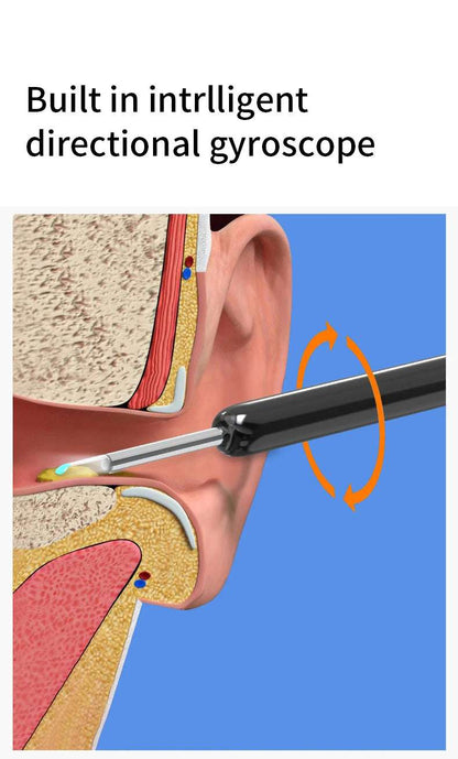 NE3 Otoscope oreille : suppression de cérumen.