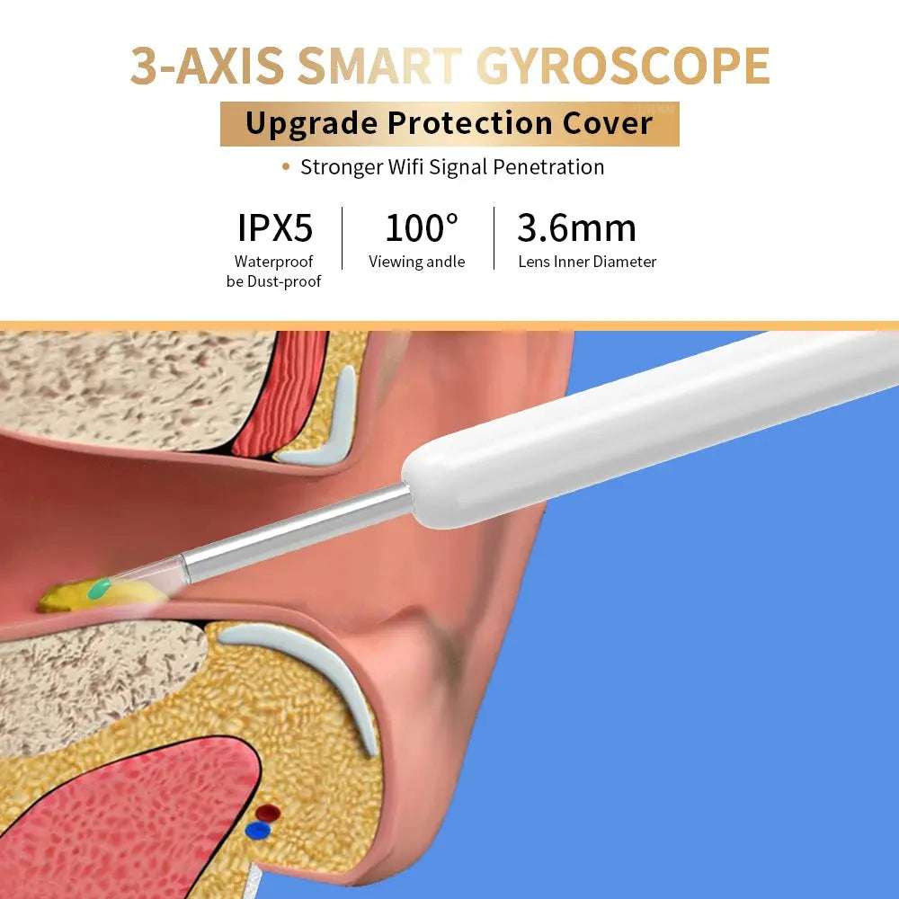 NE3 Otoscope oreille : suppression de cérumen.